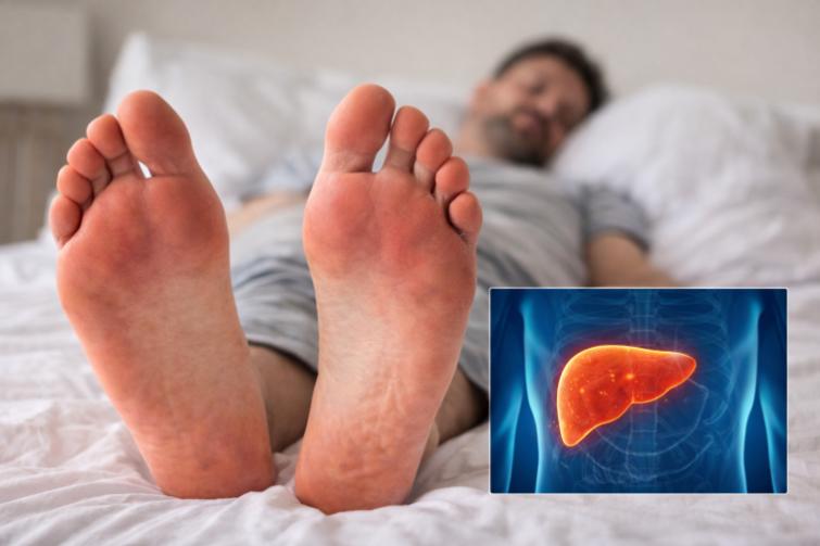 Les pieds sont-ils un signe silencieux des maladies du foie ?