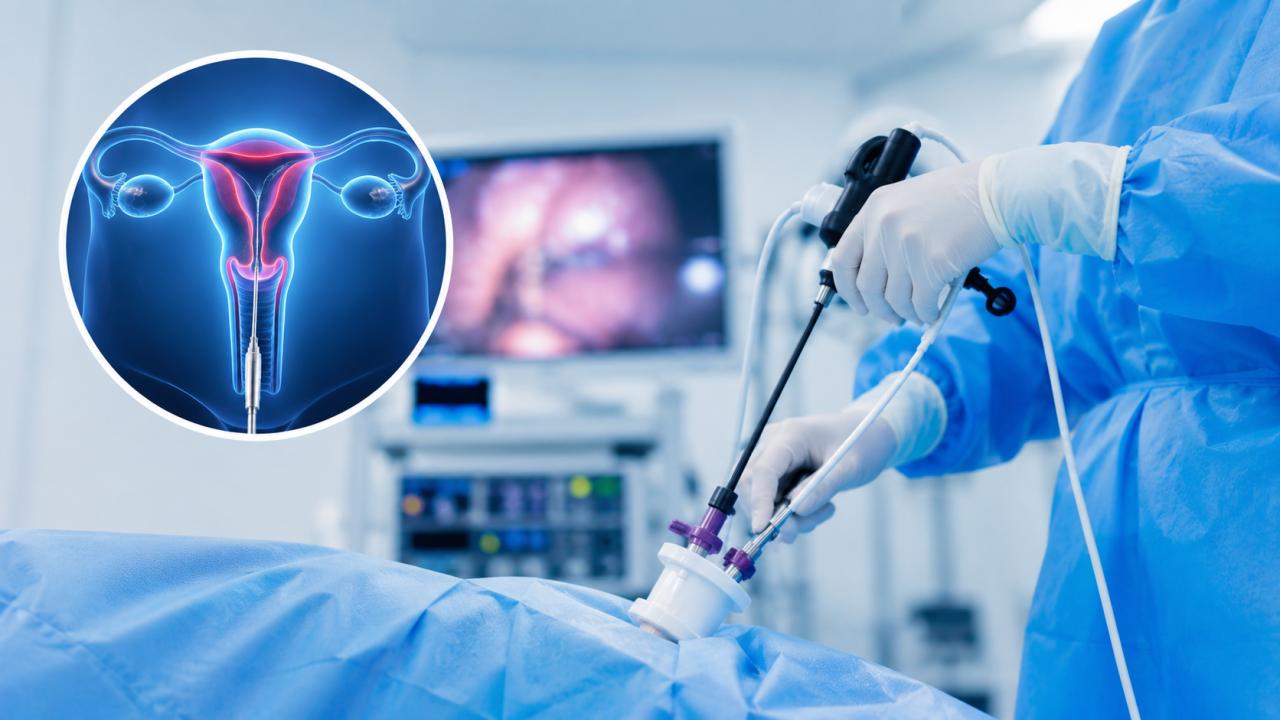 Une nouvelle approche en chirurgie gynécologique : qu’est-ce que le vNOTES ?